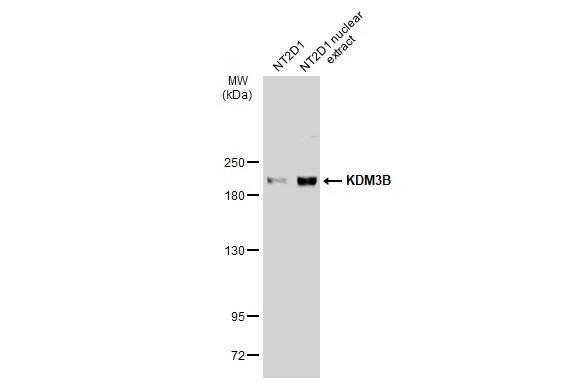 JMJD1B Antibody