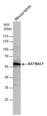KATNAL1 Antibody - BSA Free