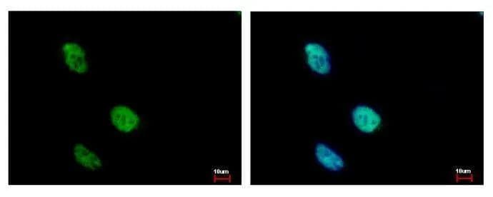 KLHDC4 Antibody - BSA Free