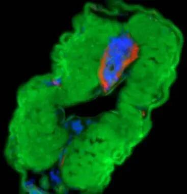 LOXL1 Antibody