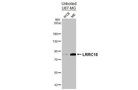 LRRC15 Antibody