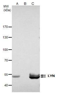 Lyn Antibody