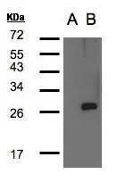 LYPLA1 Antibody - BSA Free