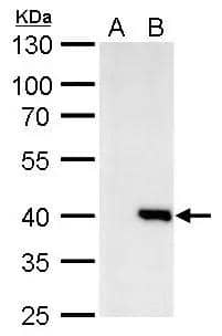 Macro H2A.2 Antibody