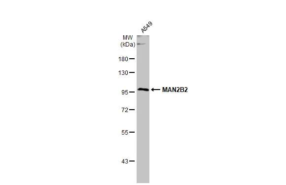 MAN2B2 Antibody