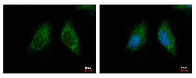 MCCC2 Antibody - BSA Free