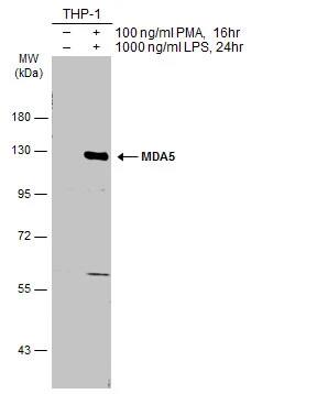 MDA5 Antibody
