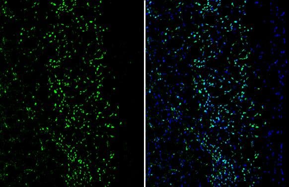 MEF2C Antibody - BSA Free