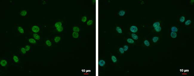 MLLT6 Antibody - BSA Free
