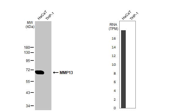 MMP-13 Antibody