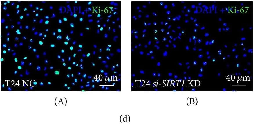 Ki67/MKI67 Antibody