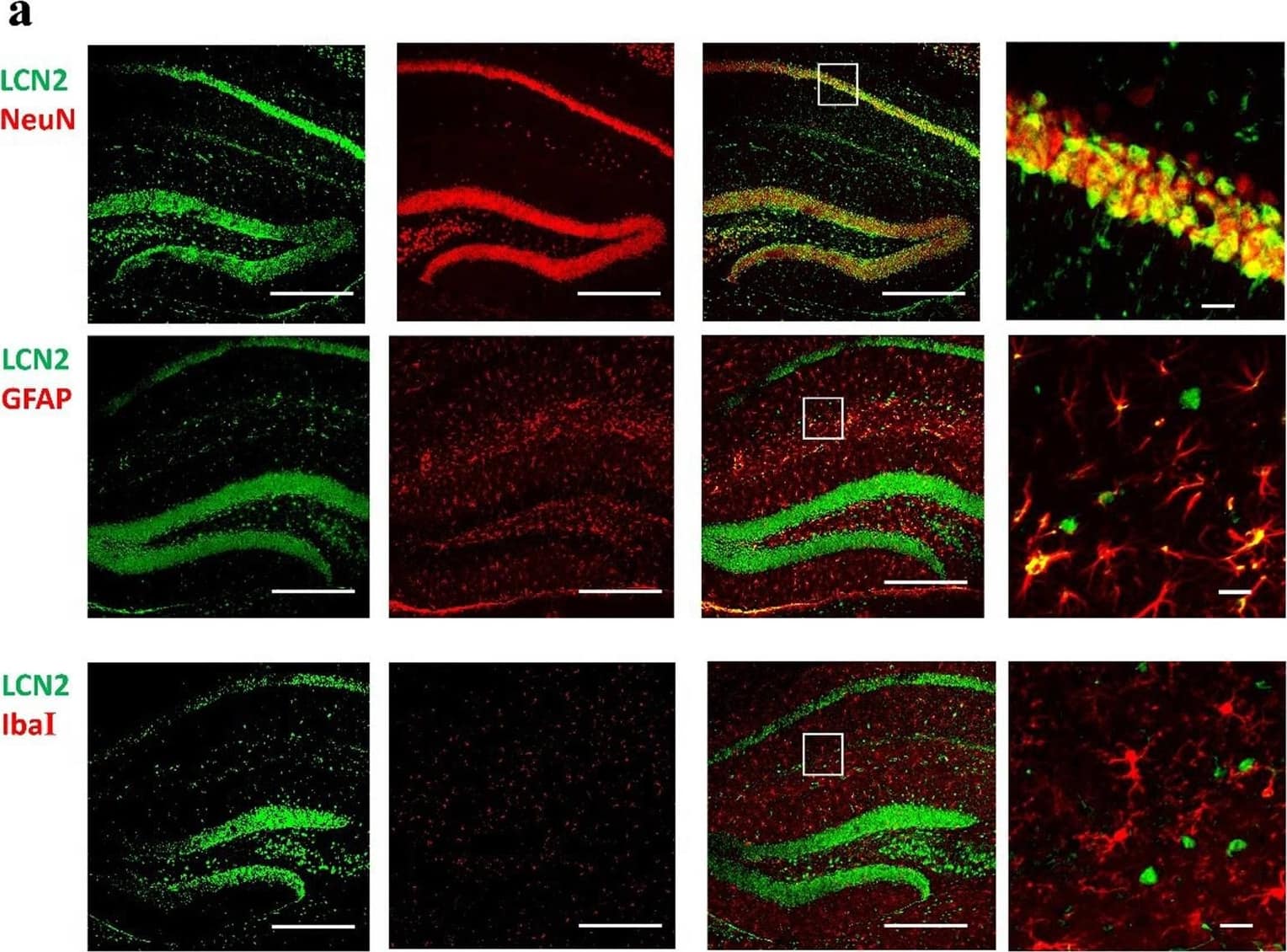 AIF-1/Iba1 Antibody
