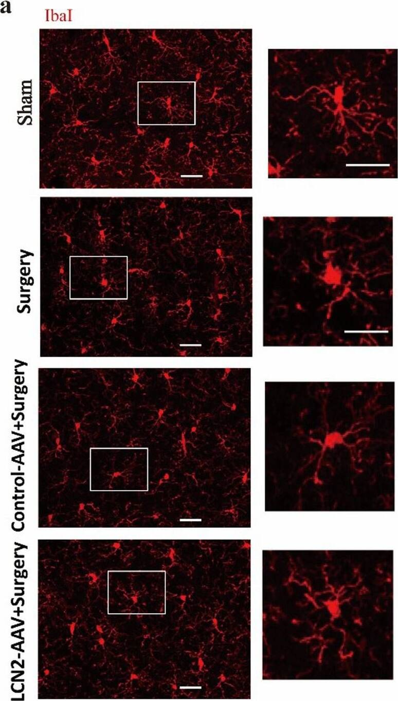AIF-1/Iba1 Antibody