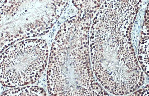 TET1 Antibody - BSA Free