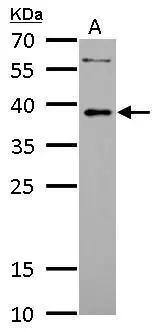 LDB3 Antibody