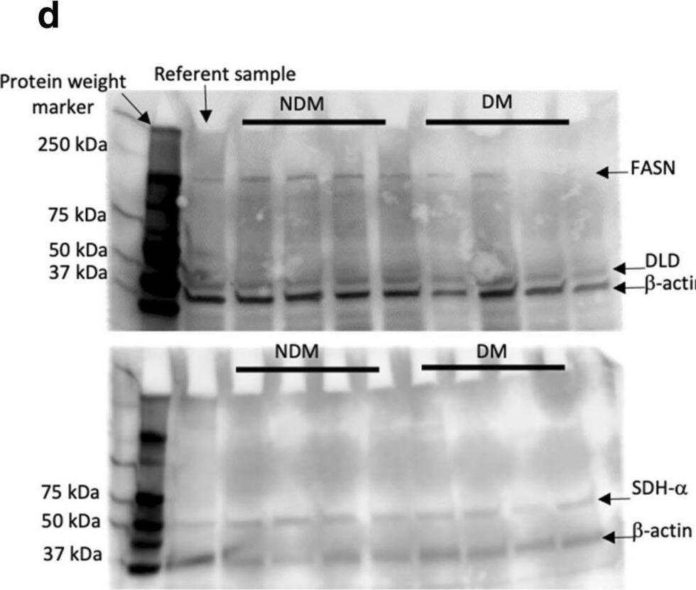 Dihydrolipoamide Dehydrogenase/DLD Antibody