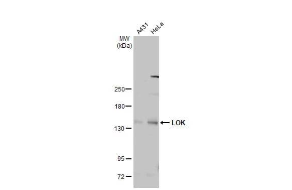LOK Antibody