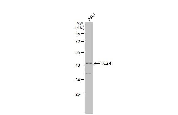 MTAC2D1 Antibody