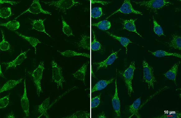 mtTFA Antibody