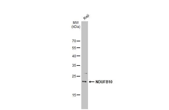 NDUFB10 Antibody