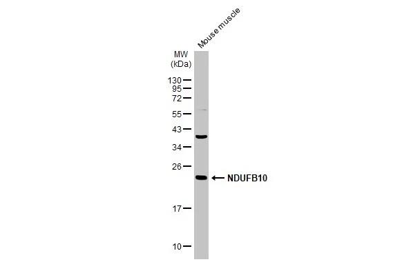 NDUFB10 Antibody