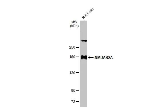 NMDAR2A Antibody