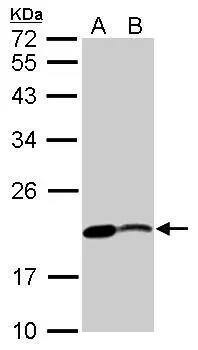 NM23-H2/NME2 Antibody