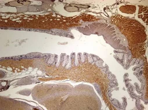 NM23-H2/NME2 Antibody