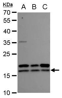 NM23-H2/NME2 Antibody