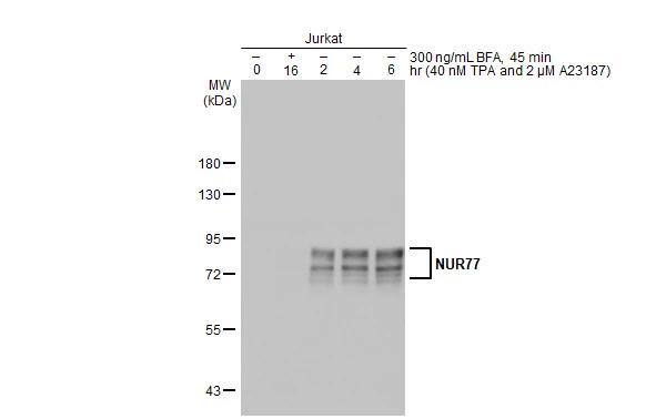 NGFI-B alpha/Nur77/NR4A1 Antibody