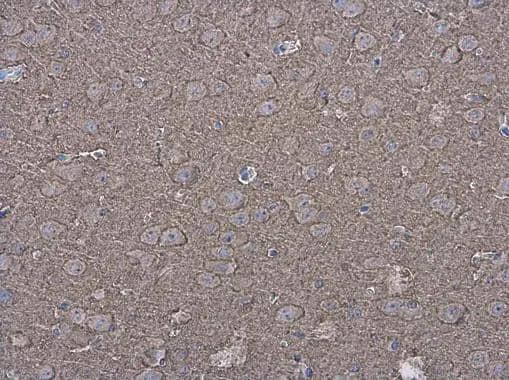 P2X7/P2RX7 Antibody - BSA Free