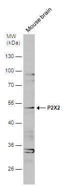 P2X2/P2RX2 Antibody