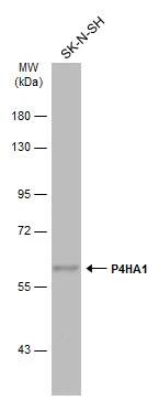 P4HA1 Antibody