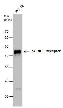 NGFR/TNFRSF16/p75NTR Antibody