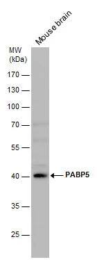 PABPC5 Antibody