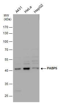 PABPC5 Antibody
