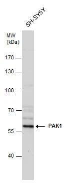 PAK1 Antibody - BSA Free