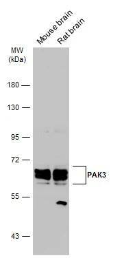 PAK3 Antibody