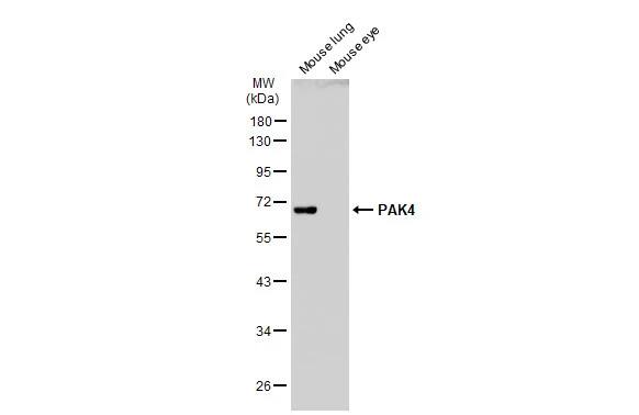 PAK4 Antibody