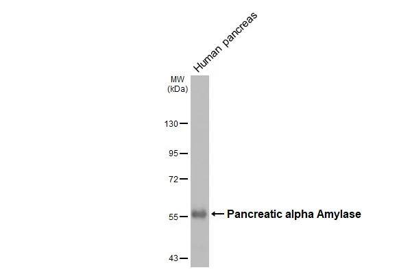 Pancreatic Amylase Beta Antibody - BSA Free
