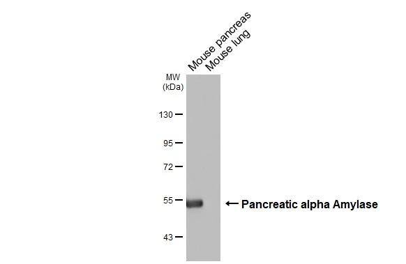 Pancreatic Amylase Beta Antibody - BSA Free