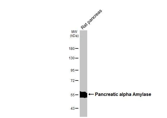 Pancreatic Amylase Beta Antibody - BSA Free
