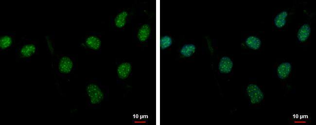 PASD1 Antibody - BSA Free