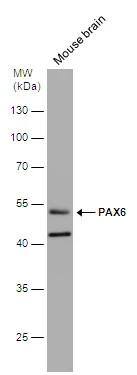 Pax6 Antibody - BSA Free