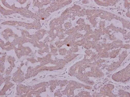 PCYT2 Antibody