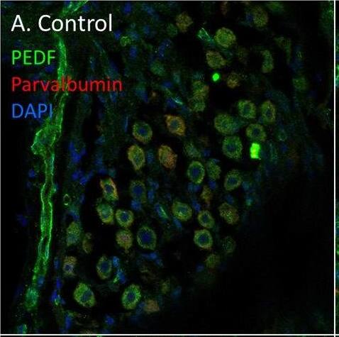 Serpin F1/PEDF Antibody - BSA Free