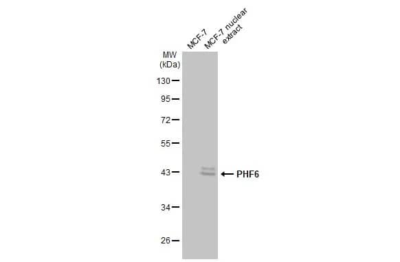 PHF6 Antibody