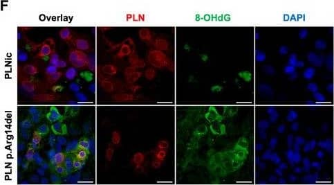 Phospholamban Antibody - BSA Free