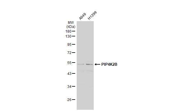 PIP5K2B Antibody - BSA Free