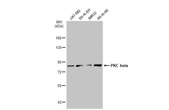 PKC beta Antibody
